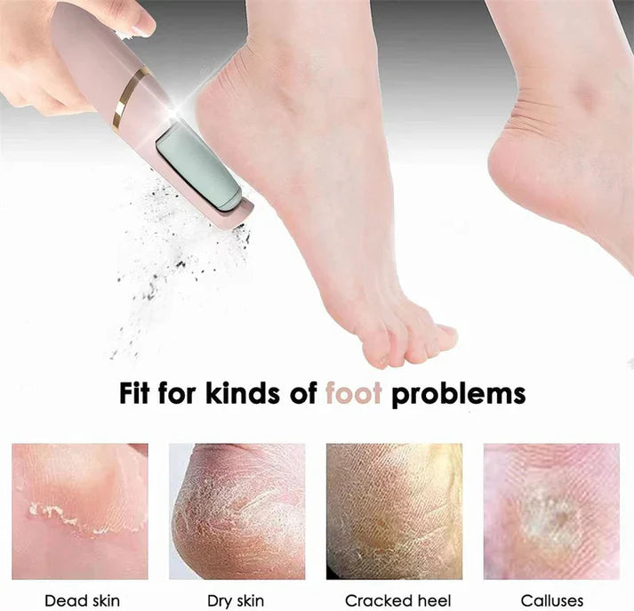 Electric Foot Callus Remover – Rechargeable Pedicure File for Dead Skin, Cracked Heels & Smooth Feet