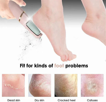 Electric Foot Callus Remover – Rechargeable Pedicure File for Dead Skin, Cracked Heels & Smooth Feet